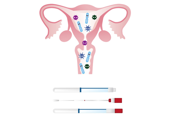 パッケージデザイン